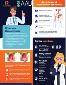 Hemorrhoid infographic